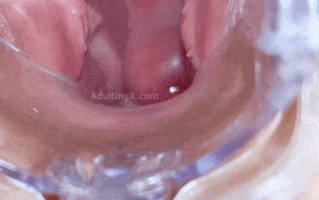 1-【内窥稀有资源】子宫颈显示和窥器播放