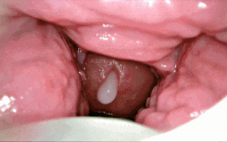 44-【内窥】一遍又一遍地射在我体内！阴道内的摄像头内射子宫颈 POV