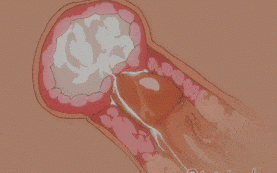 新作-Nami - Kokoboro