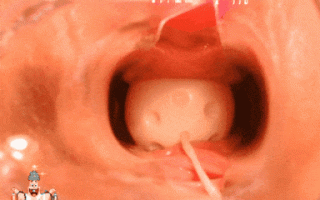 48【内窥-美穴-阴蒂-子宫口】稀缺资源阴道内放置跳蛋高清近景内窥镜看阴道内部变化白浆往外流再给你看看子宫口太粉嫩了