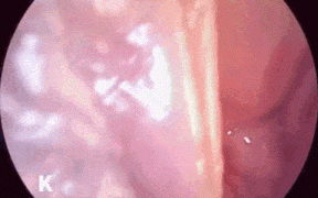 45-【内窥】一名前护士，将观察并介绍阴道内部，近观欢乐豆跟骚穴