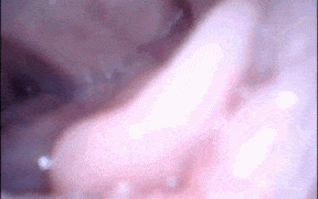 14【内窥】口中摄像头阴道和屁股